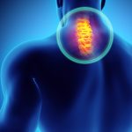 Radicular Pain After Spinal Cord Injury: What Is It?
